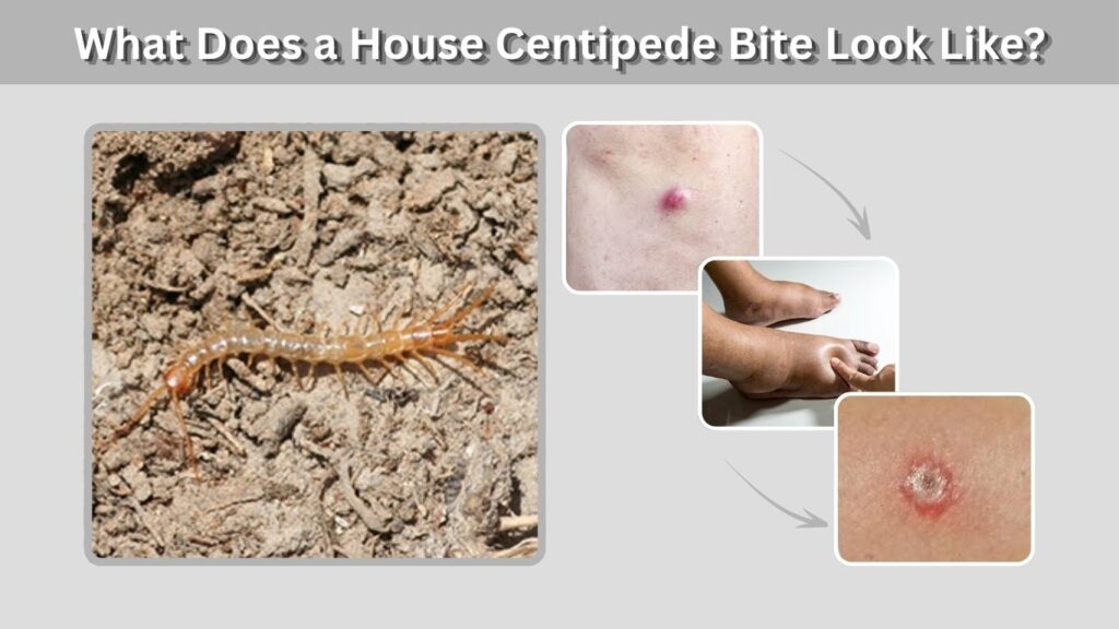 What Does a House Centipede Bite Look Like?