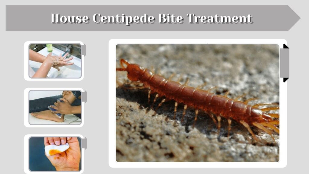 House Centipede Bite Treatment