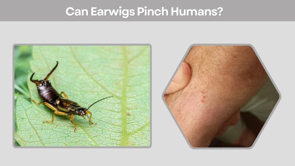 Can Earwigs Pinch Humans?