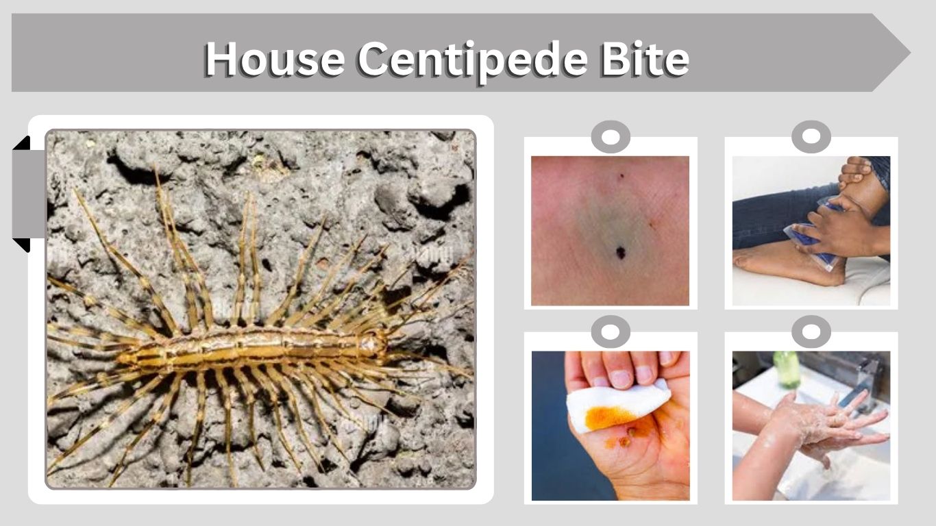House Centipede Bite: Symptoms, Risks and Treatment Guide