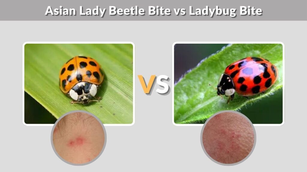 Asian Lady Beetle Bite vs Ladybug Bite
