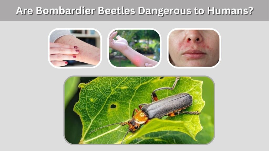 Are Bombardier Beetles Dangerous to Humans?