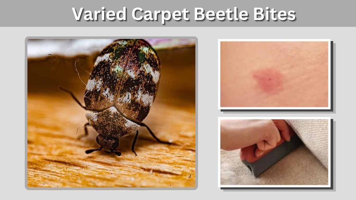 Varied Carpet Beetle Bites: Do They Bite Humans?