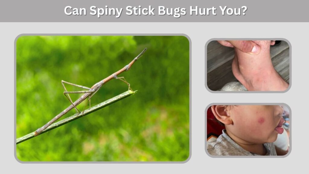 Can Spiny Stick Bugs Hurt You?