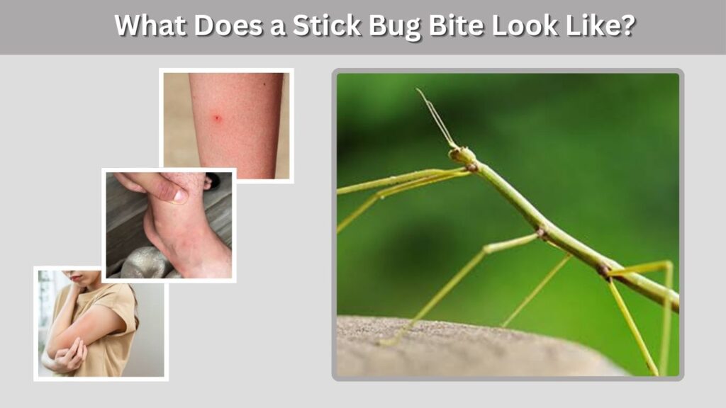 What Does a Stick Bug Bite Look Like?