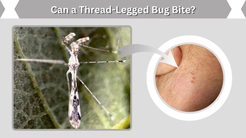 Can a Thread-Legged Bug Bite?