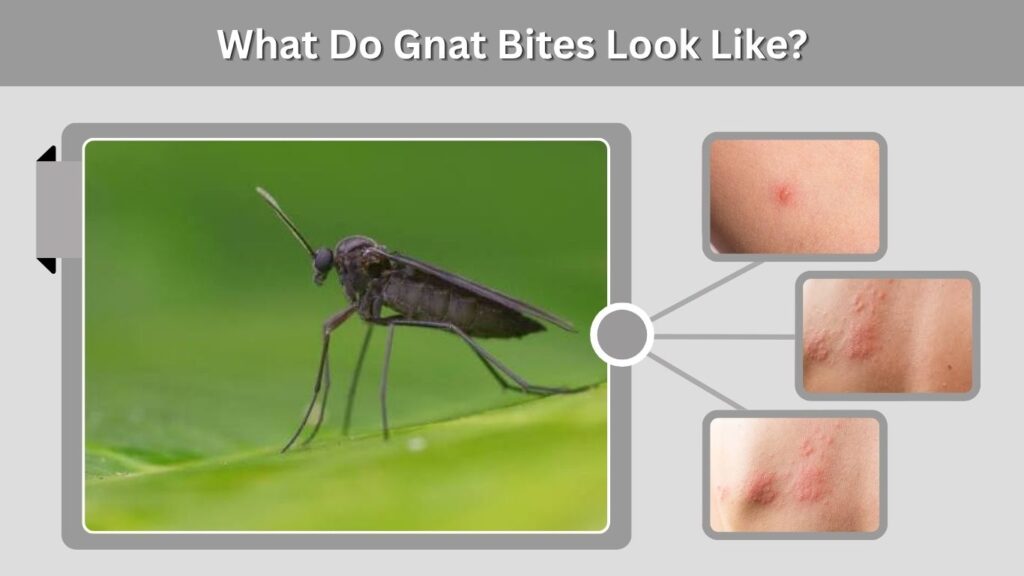 What Do Gnat Bites Look Like?