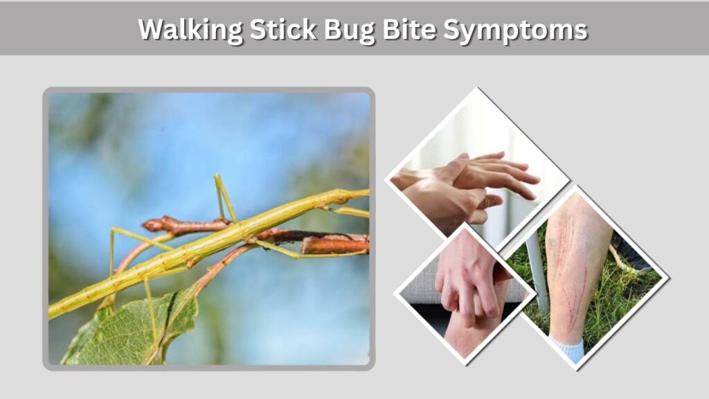 Walking Stick Bug Bite Symptoms