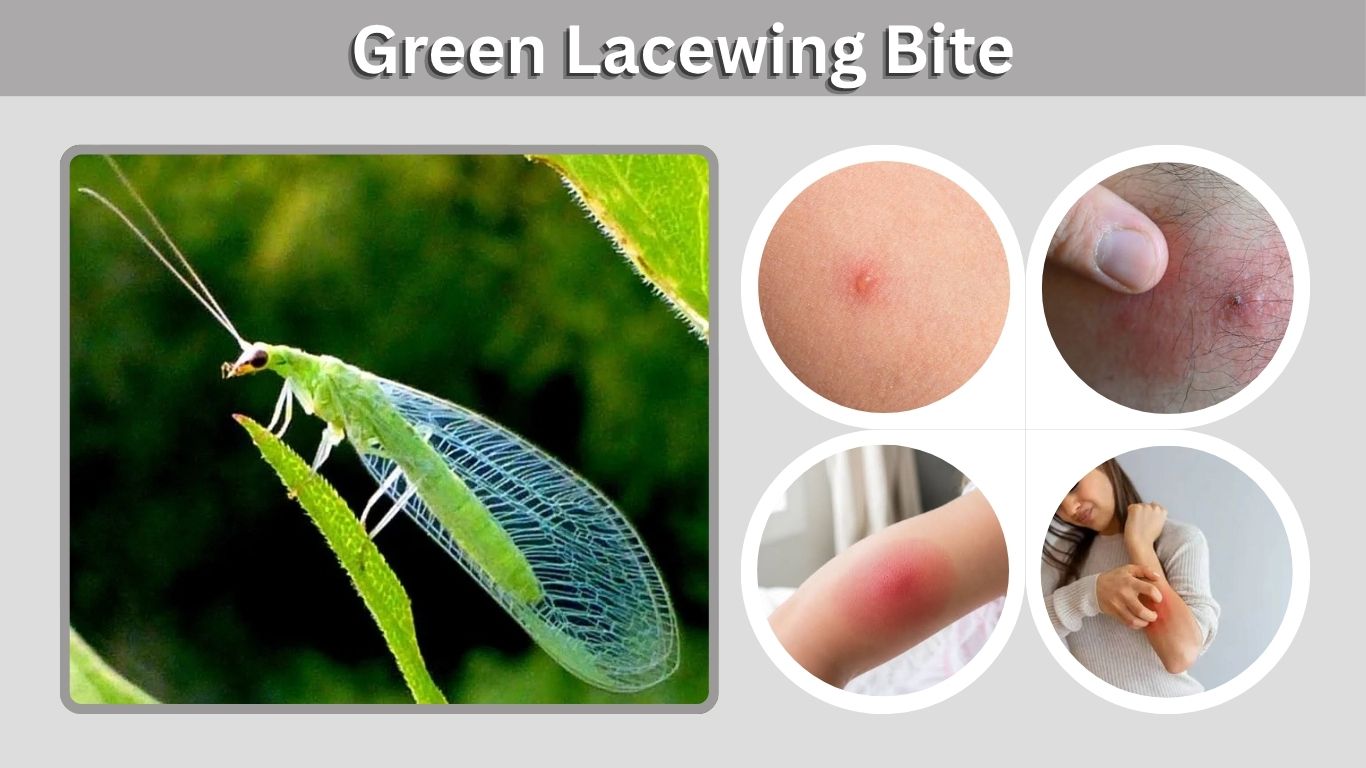 Green Lacewing Bite: Symptoms, Treatment & Risks