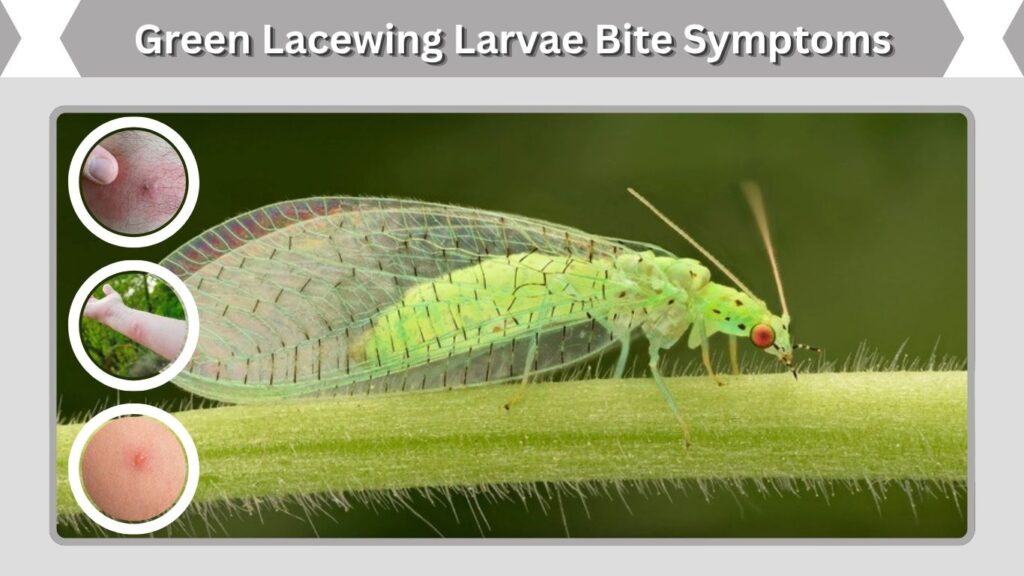 Green Lacewing Larvae Bite Symptoms