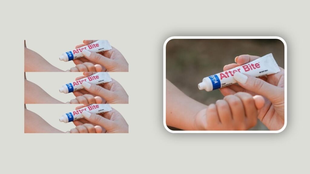 After Bite Kids Itch Relief Cream