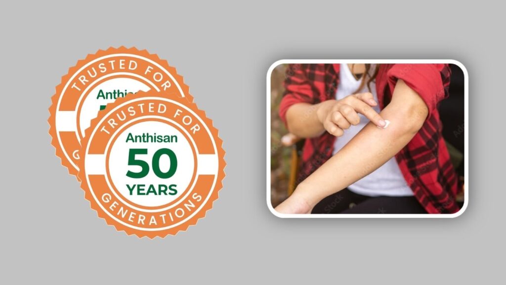 Anthisan Bite & Sting Cream