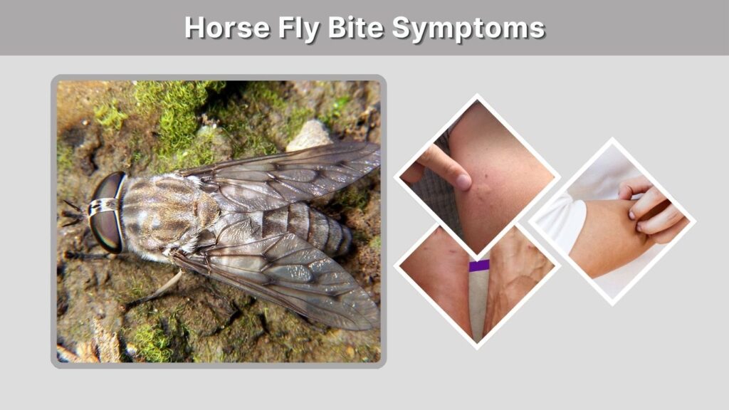 Horse Fly Bite Symptoms