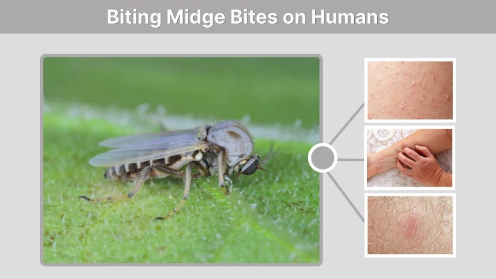 Biting Midge Bites on Humans