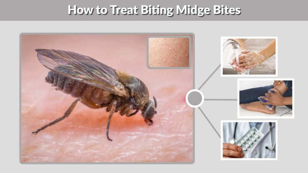 How to Treat Biting Midge Bites