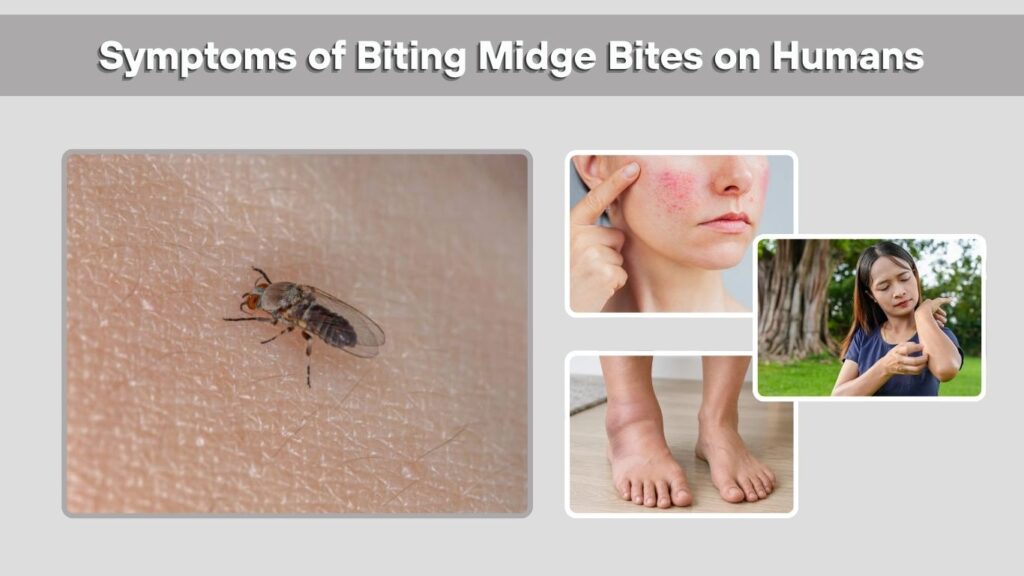 Symptoms of Biting Midge Bites on Humans