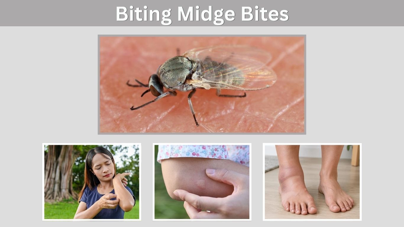 Biting Midge Bites: Symptoms, Treatment & Relief