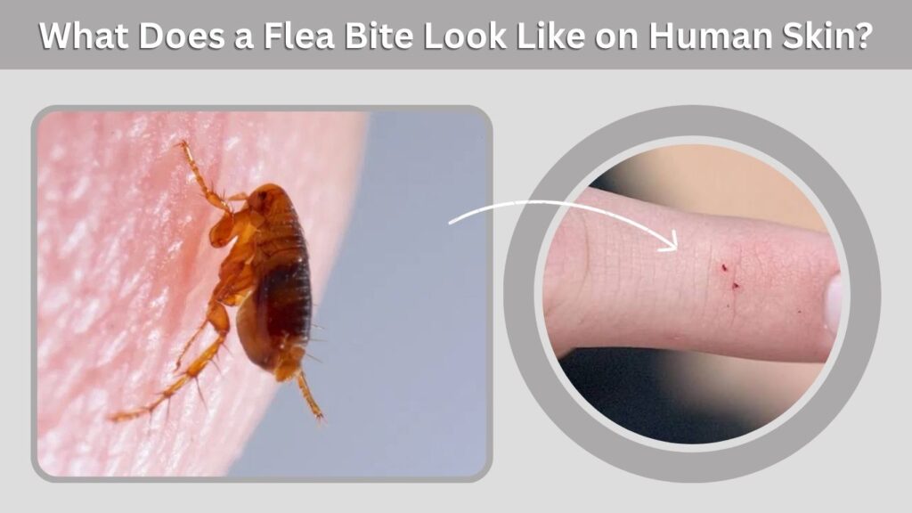 What Does a Flea Bite Look Like on Human Skin?