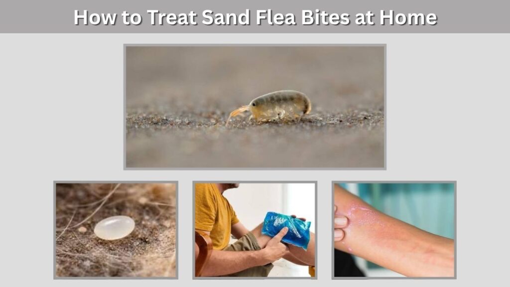 How to Treat Sand Flea Bites at Home
