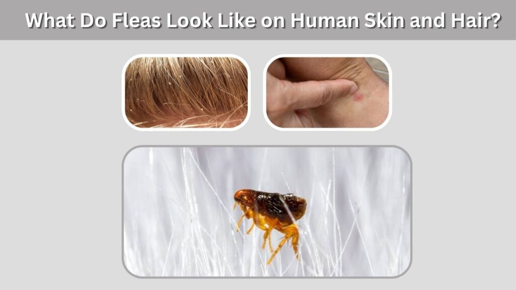 What Do Fleas Look Like on Human Skin and Hair?
