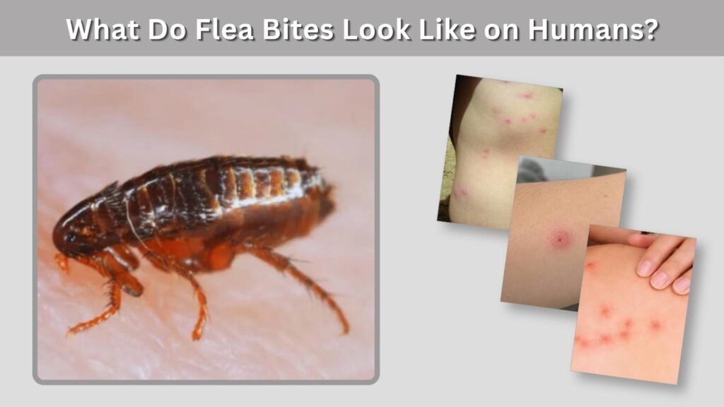 What Do Flea Bites Look Like on Humans?