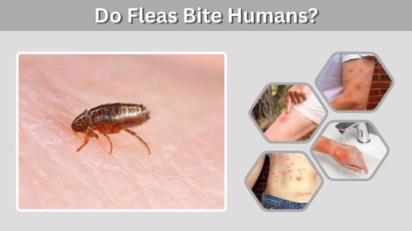 Do Fleas Bite Humans? Symptoms, Causes & Treatment