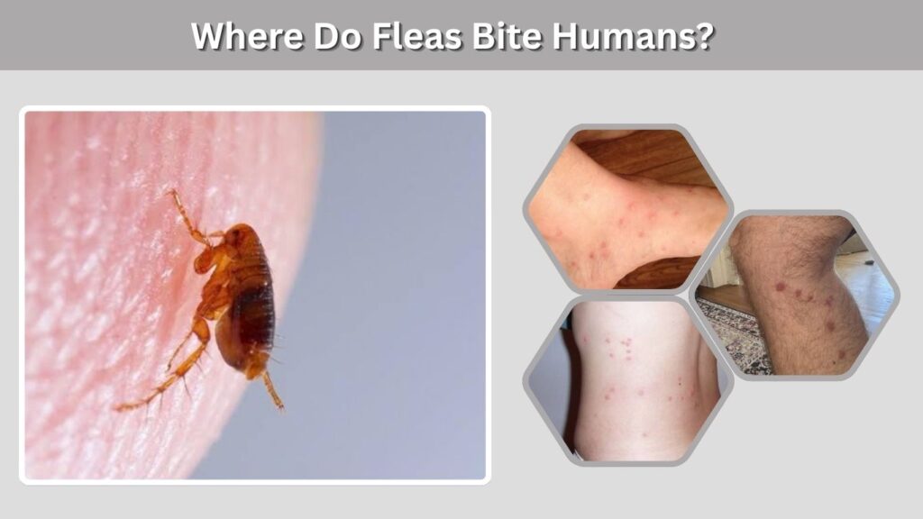 Where Do Fleas Bite Humans?