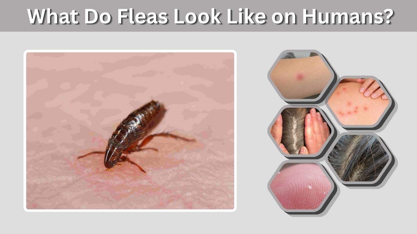 What Do Fleas Look Like on Humans? Signs & Bites