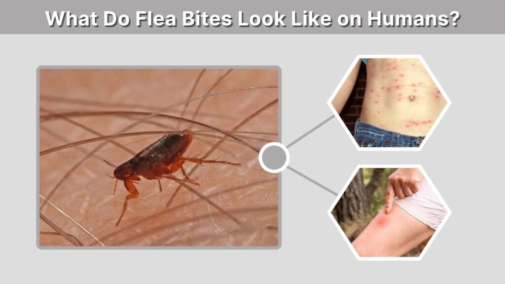 What Do Flea Bites Look Like on Humans?