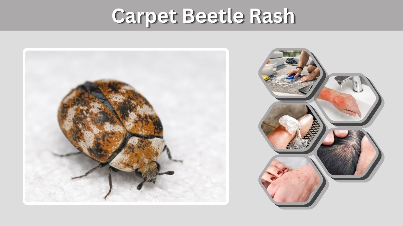 Carpet Beetle Rash: Symptoms, Treatment, and Causes