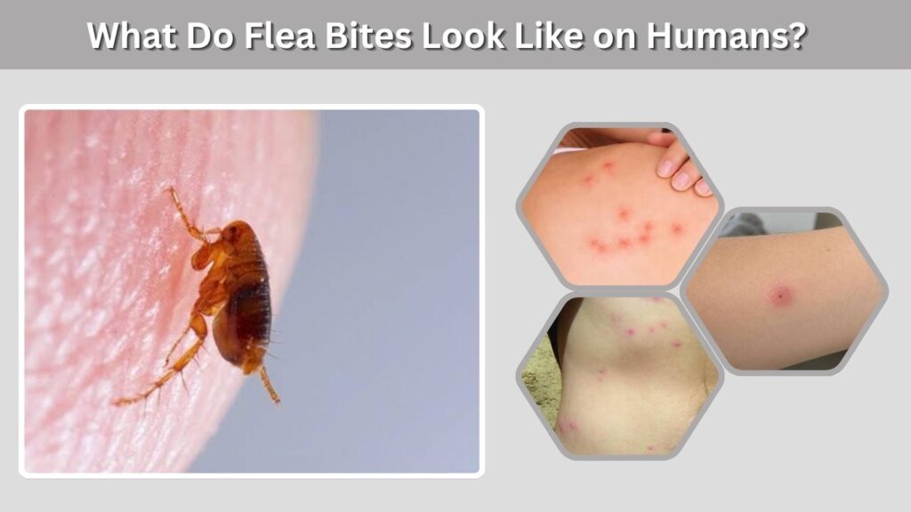 What Do Flea Bites Look Like on Humans?