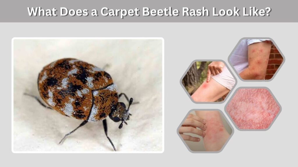 What Does a Carpet Beetle Rash Look Like?
