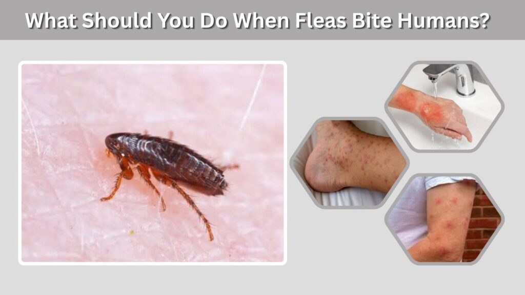 What Should You Do When Fleas Bite Humans?