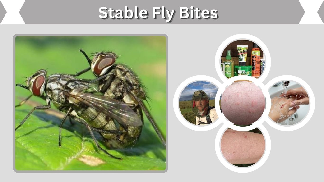 Stable Fly Bites: Symptoms, Treatment, and Prevention