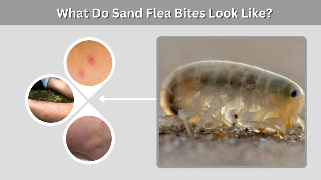 What Do Sand Flea Bites Look Like?