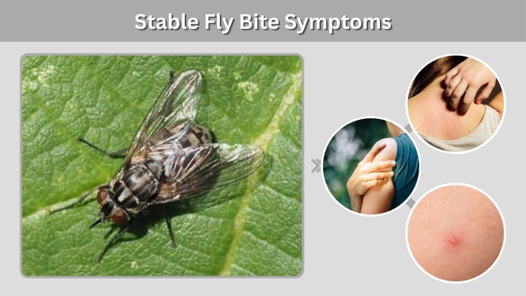 Stable Fly Bite Symptoms