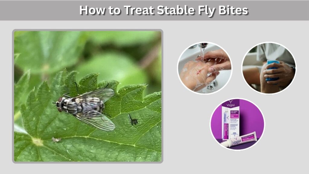How to Treat Stable Fly Bites