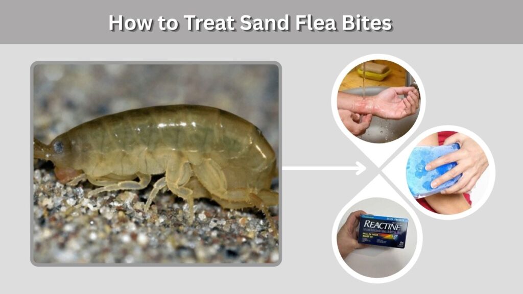How to Treat Sand Flea Bites
