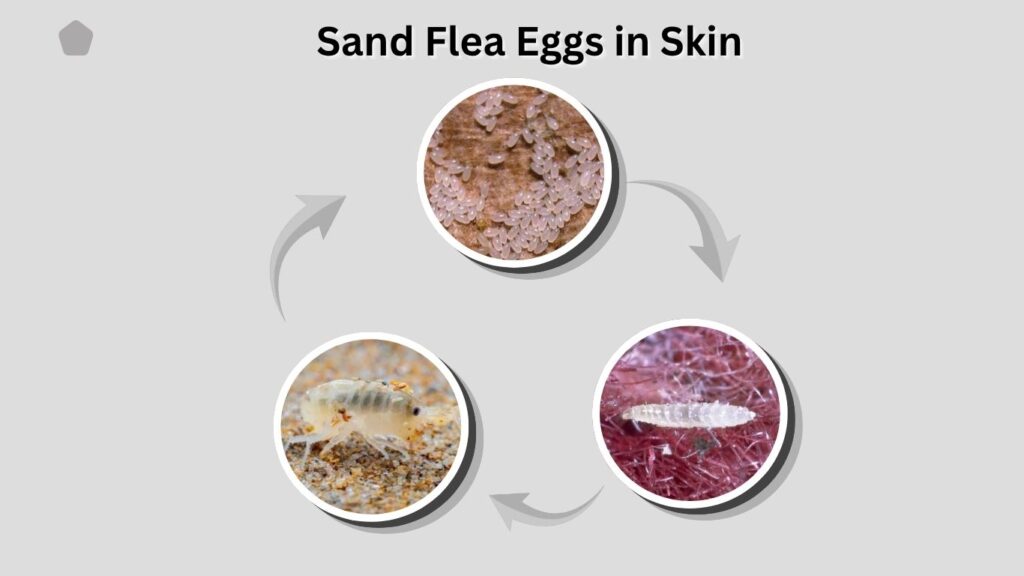 Sand Flea Eggs in Skin