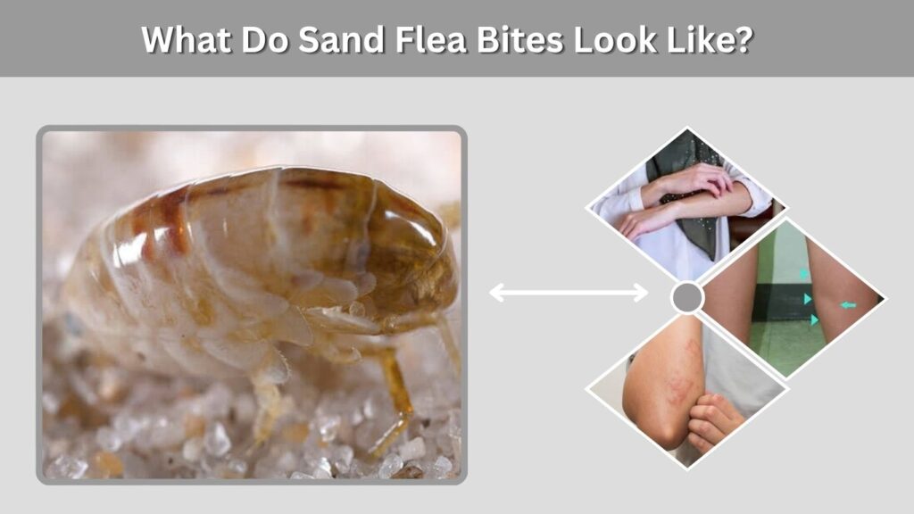 What Do Sand Flea Bites Look Like?