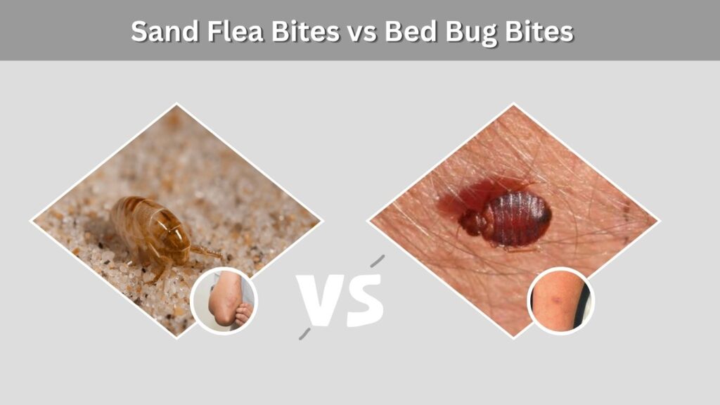 Sand Flea Bites vs Bed Bug Bites