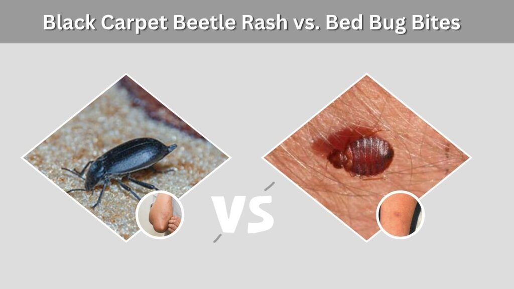 Black Carpet Beetle Rash vs. Bed Bug Bites