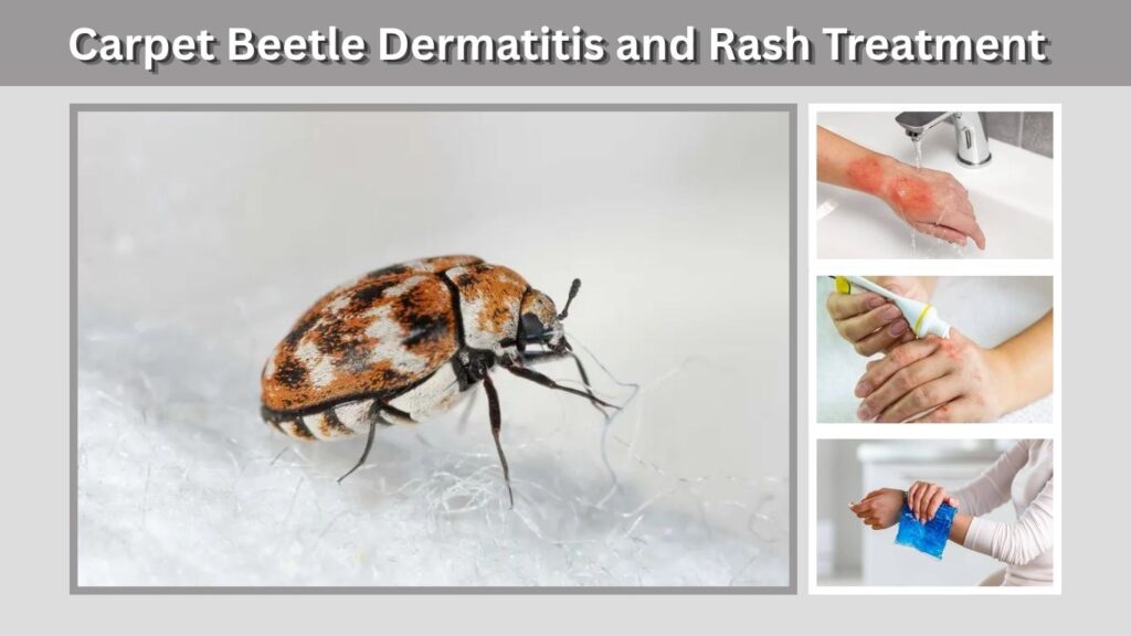Carpet Beetle Dermatitis and Rash Treatment