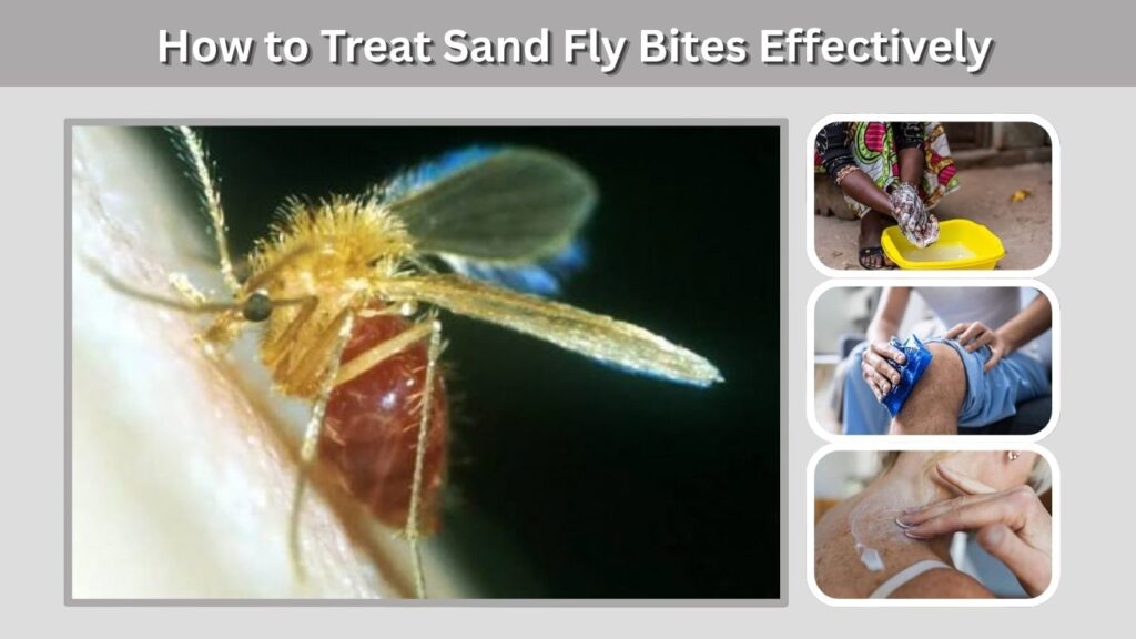 How to Treat Sand Fly Bites Effectively