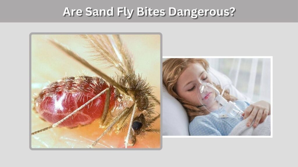 Are Sand Fly Bites Dangerous?