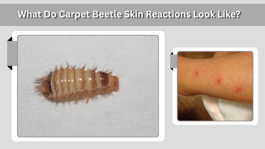 What Do Carpet Beetle Skin Reactions Look Like?