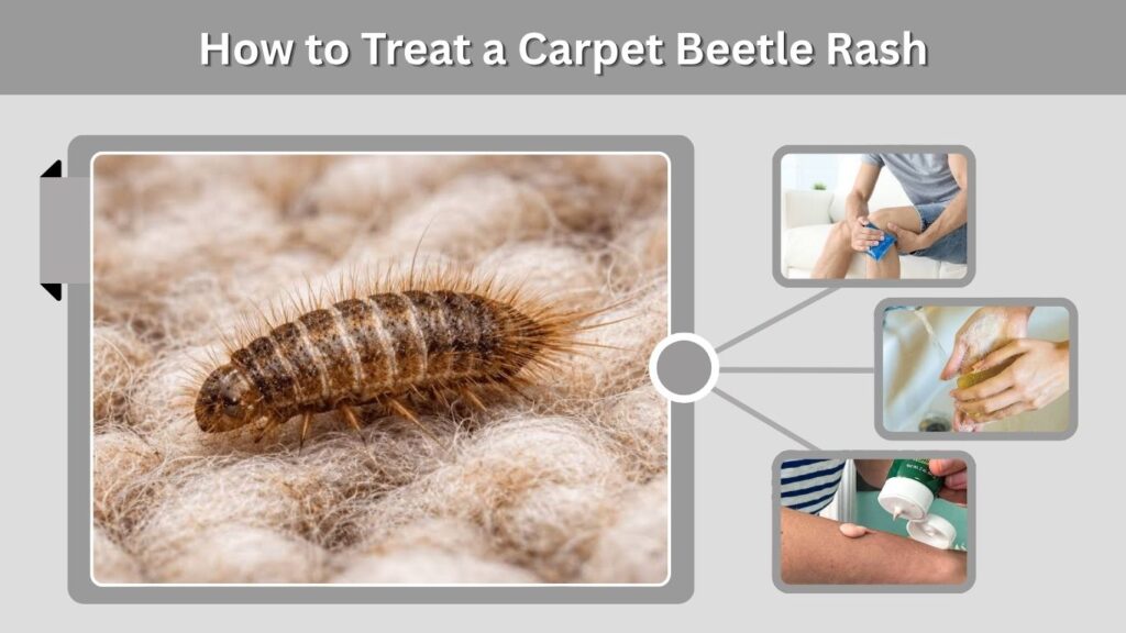 How to Treat a Carpet Beetle Rash
