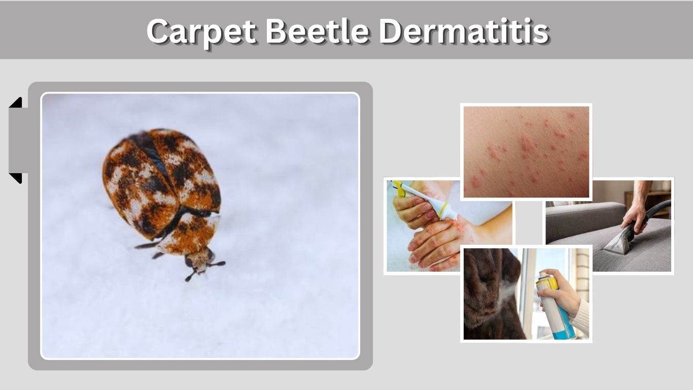 Carpet Beetle Dermatitis: Symptoms, Treatment, and Cure