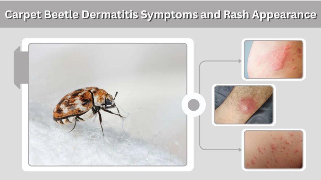 Carpet Beetle Dermatitis Symptoms and Rash Appearance