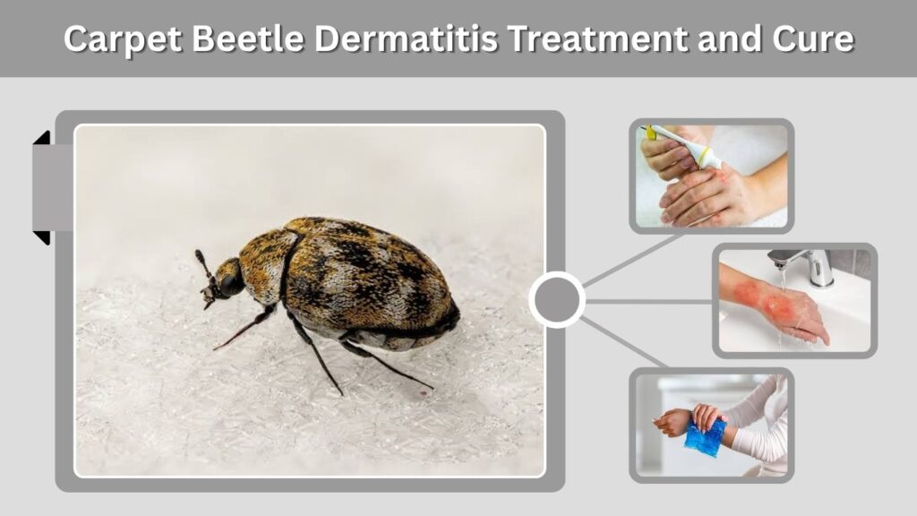 Carpet Beetle Dermatitis Treatment and Cure